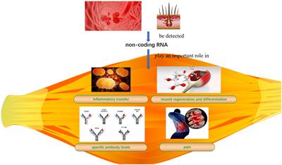 Idiopathic inflammatory myopathy and non-coding RNA